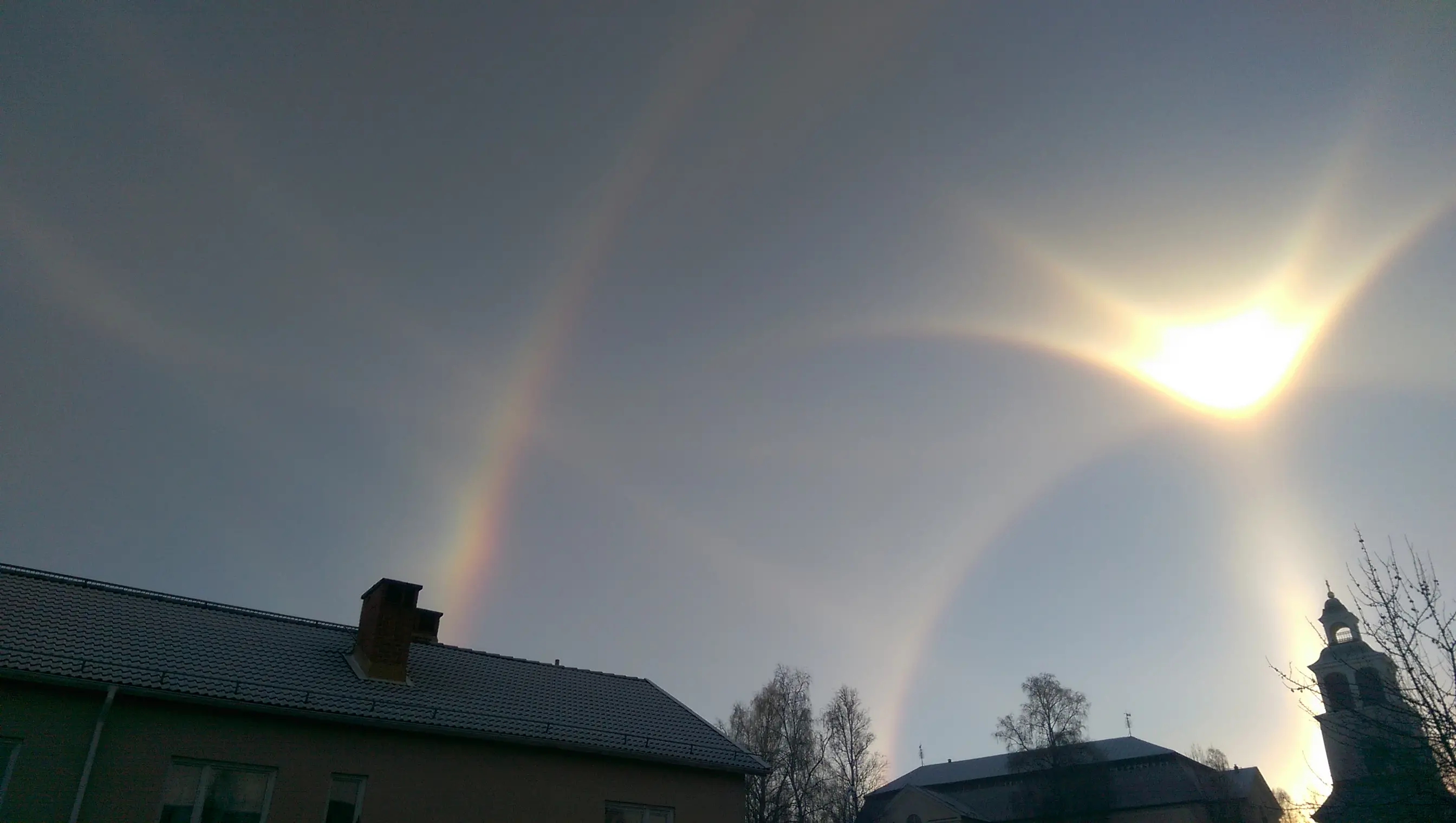 Parrys supralaterala båge.